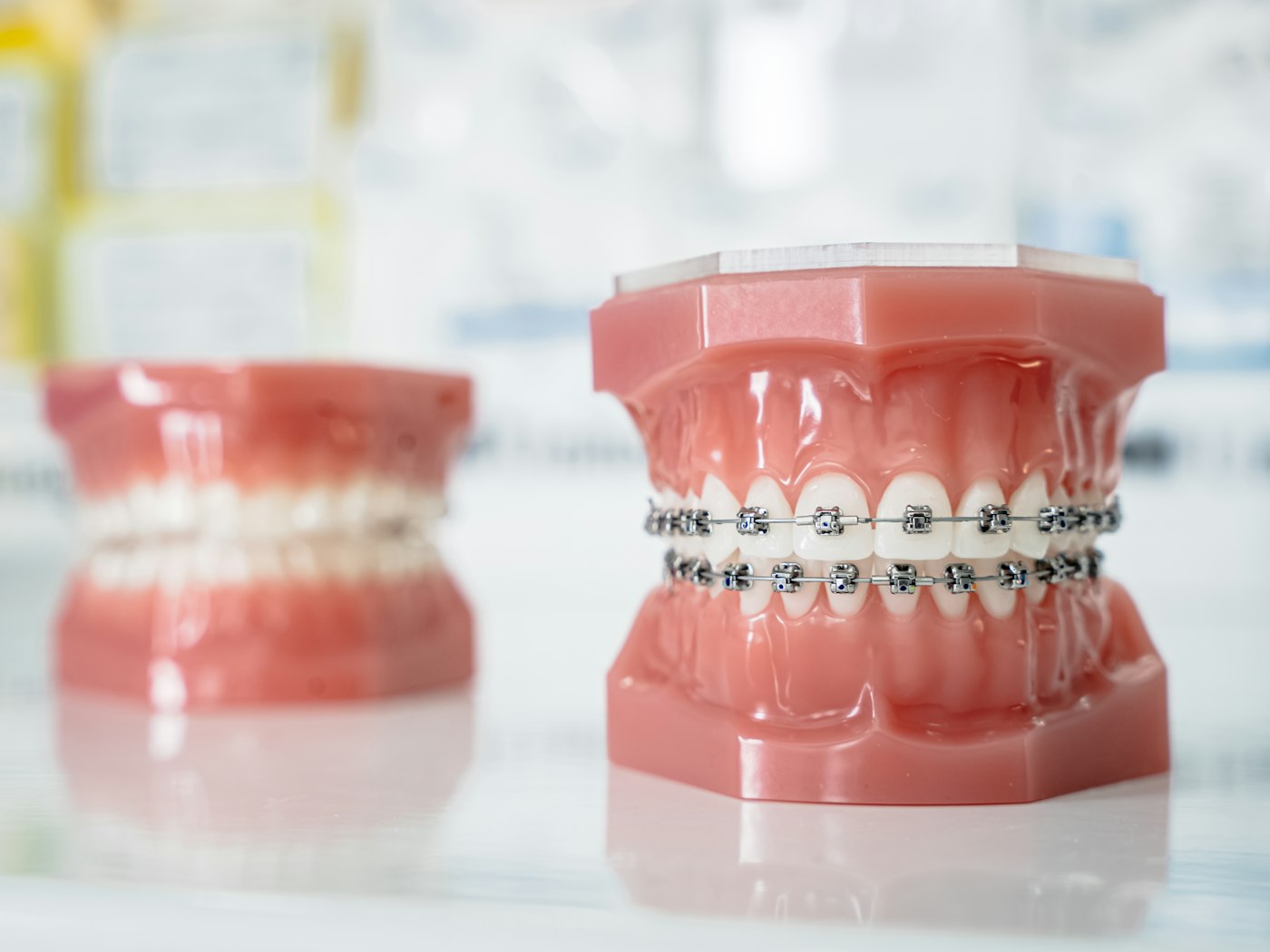 Dental models showing teeth with braces