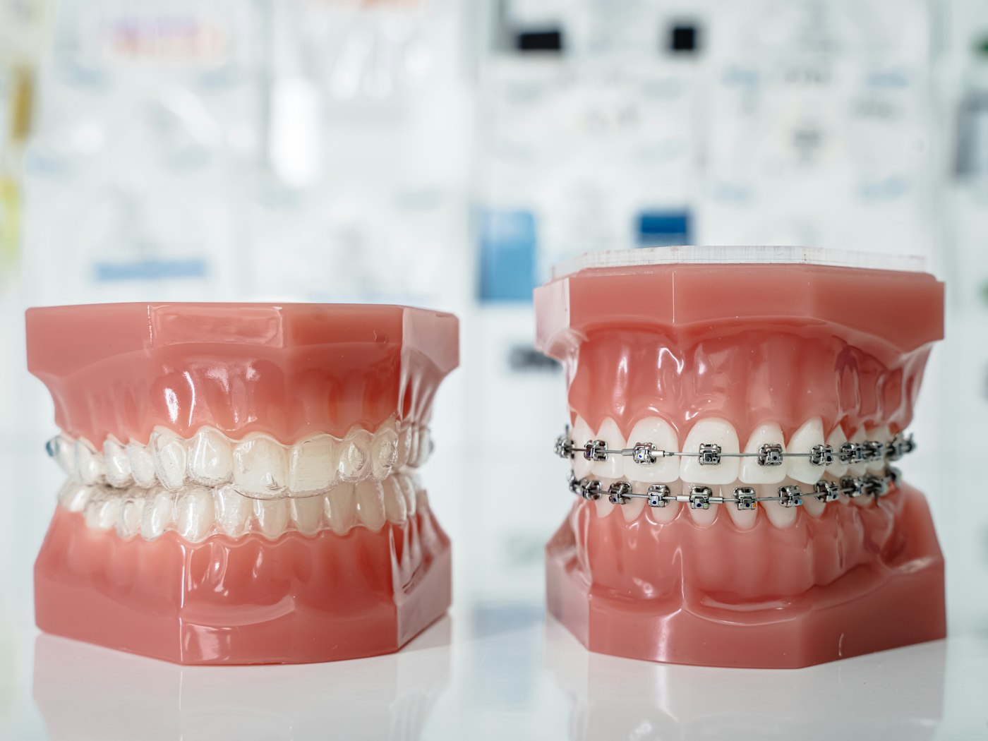 Dental models comparing clear and metal braces